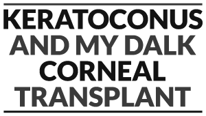 Keratoconus and my DALK Corneal Transplant